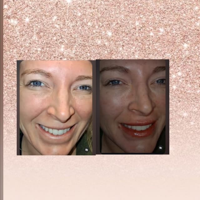 Face Harmonization fillers at Skin & Toxx Medical Spa Westchase in Houston, TX