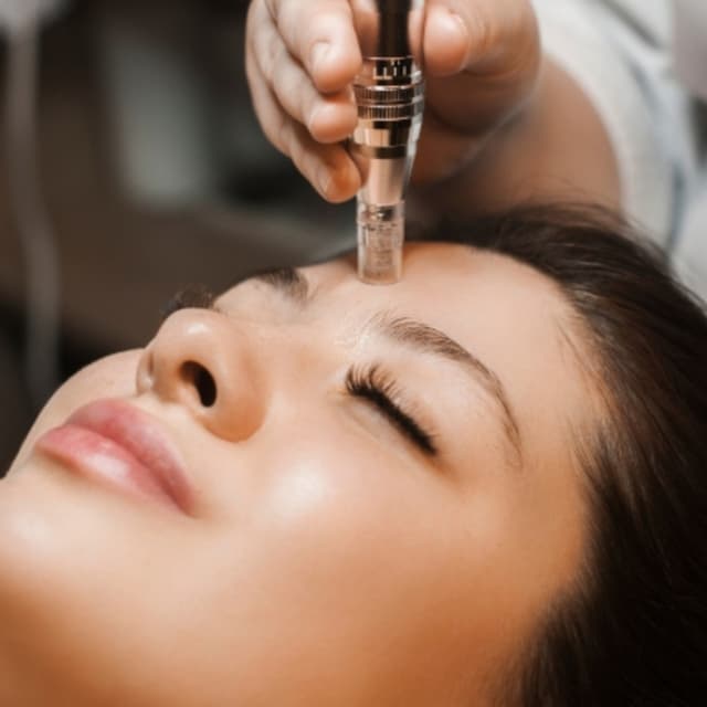 Microneedling pack of 3 at Skin & Toxx Medical Spa Westchase in Houston, TX
